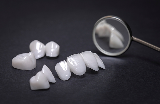 Multiple veneers sitting on dental mirror next to black surface
