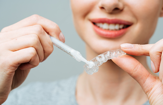 Filling teeth with whitening gel for cosmetic dentistry in Montague