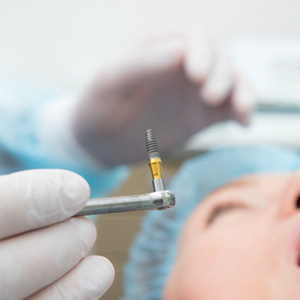 Dental implant surgery incurs a separate cost 