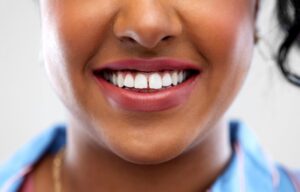 Woman with a minor gap in her smile