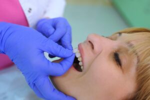 Woman getting her veneers placed
